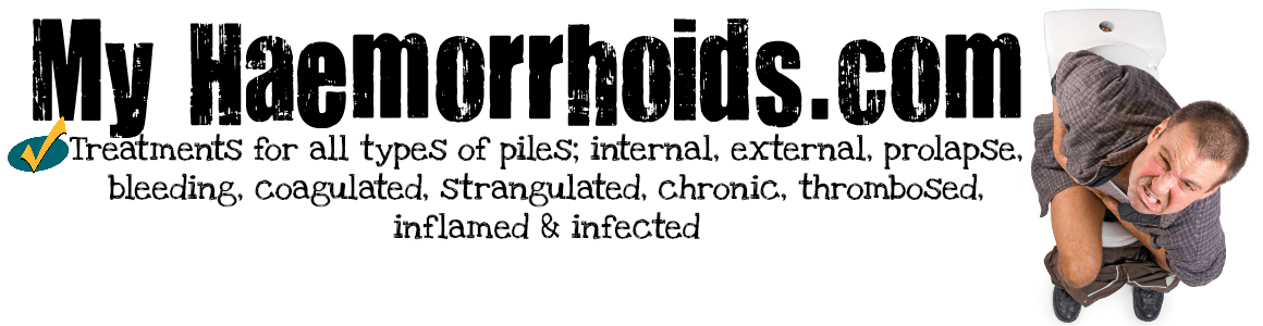 Treatments, Tips, Tricks, Products And Home Remedies To Get Rid Of Hemorrhoids (Piles) Fast